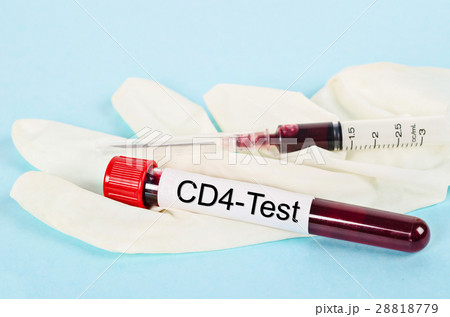Blood sample in tube for CD4 cell testing. 28818779