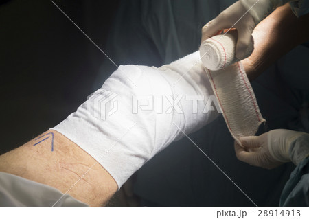 Knee surgery nurse bandaging Knee surgery nurse bandaging 28914913