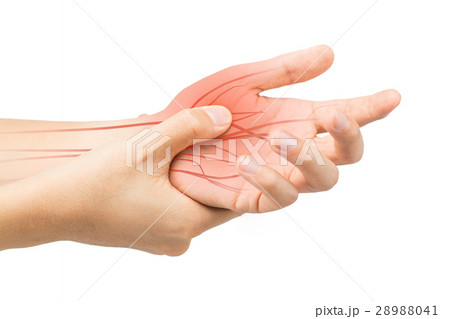 wrist nerve injury white background wrist nerve injury white background 28988041
