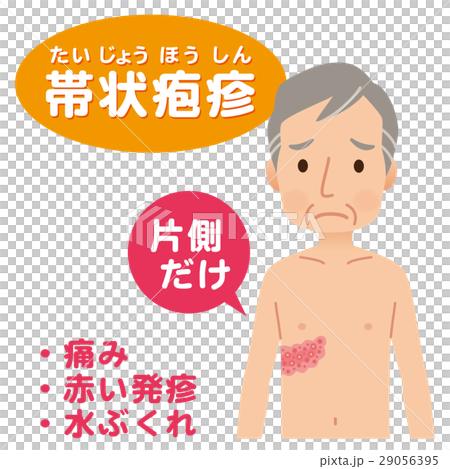 Symptoms Of Shingles Stock Illustration