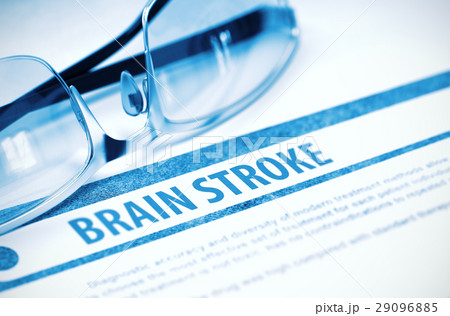 Diagnosis - Brain Stroke. Medicine Concept. 3D 29096885