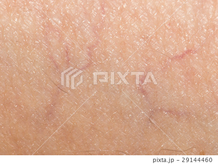 veins on the skin. close 29144460