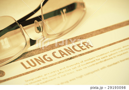 Diagnosis - Lung Cancer. Medicine Concept. 3D Diagnosis - Lung Cancer. Medicine Concept. 3D 29193098