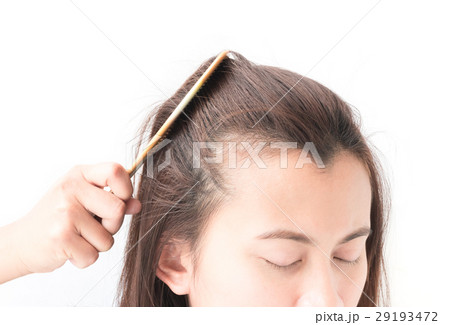 Woman serious hair loss problem for health care shampoo and beau 29193472