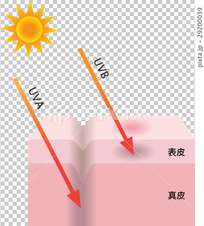 紫外線 29200039