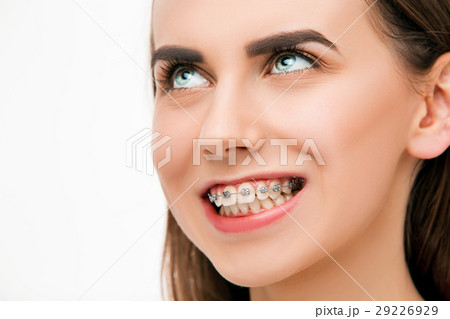Beautiful young woman with teeth braces 29226929