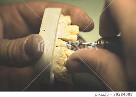 Dental Prosthesis 29284099