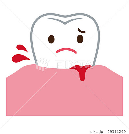 歯ぐきから出血する 歯周病のイラスト素材