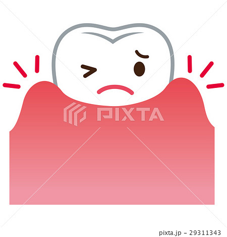 歯ぐきが腫れる 歯周病のイラスト素材 29311343 Pixta
