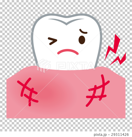 Periodontal diseases itching with gums 29311426