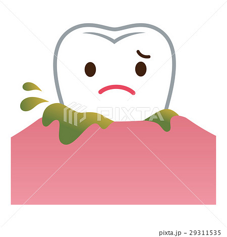 歯ぐきから膿がでる　歯周病 29311535