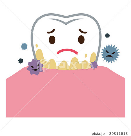 歯石　歯周病 29311618