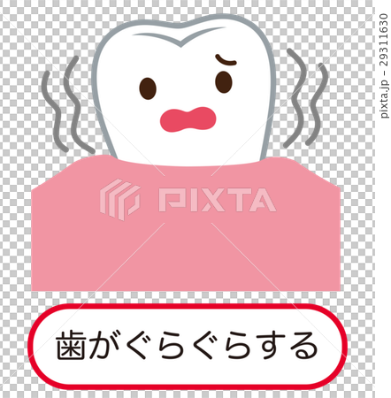 歯がぐらぐらする 歯周病 歯がぐらぐらする 歯周病 29311630