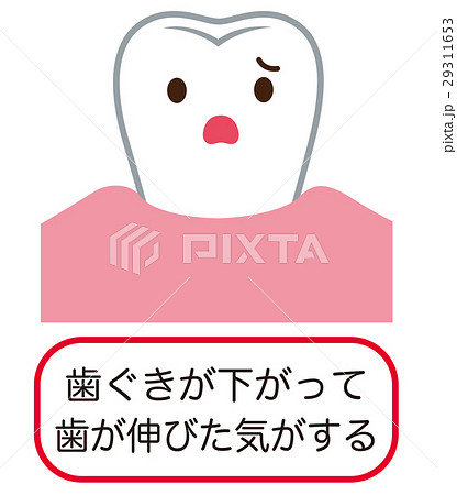 歯ぐきが下がる　歯周病 29311653