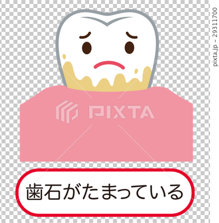 歯石　歯周病 29311700