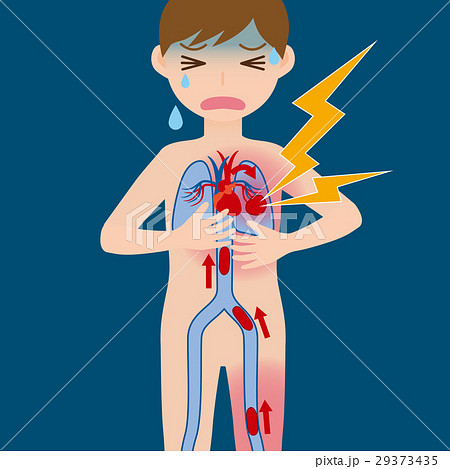 エコノミークラス症候群 エコノミークラス症候群 29373435