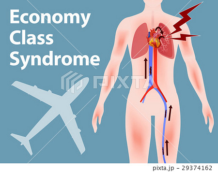 エコノミークラス症候群のイラスト素材