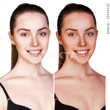 Young woman before and after tanning. Young woman before and after tanning. 29378129