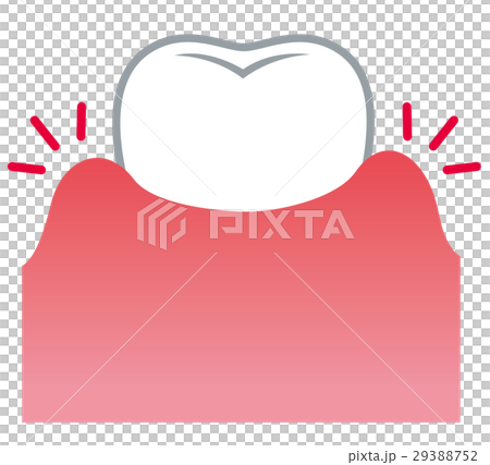 歯ぐきが腫れる 歯周病 歯ぐきが腫れる 歯周病 29388752