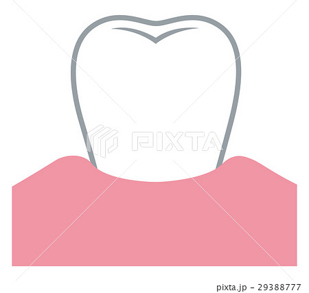 歯ぐきが下がる　歯周病 29388777