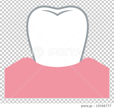 歯ぐきが下がる　歯周病 29388777