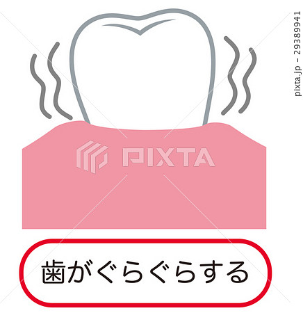歯がぐらぐらする　歯周病 29389941