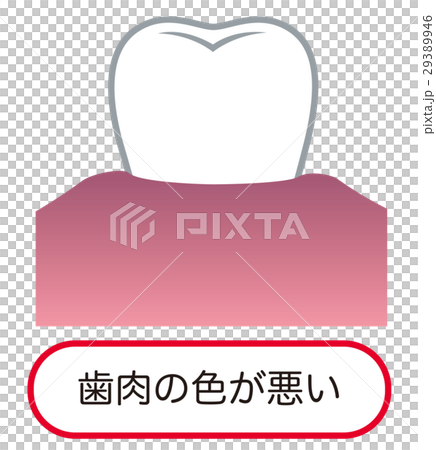 歯肉の色が悪い 歯周病 歯肉の色が悪い 歯周病 29389946