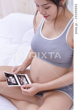 pregnant 29399993