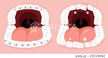 cute cartoon tooth cute cartoon tooth 29519082
