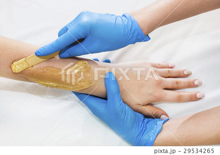Mesotherapy process on a female hand in clinic  29534265