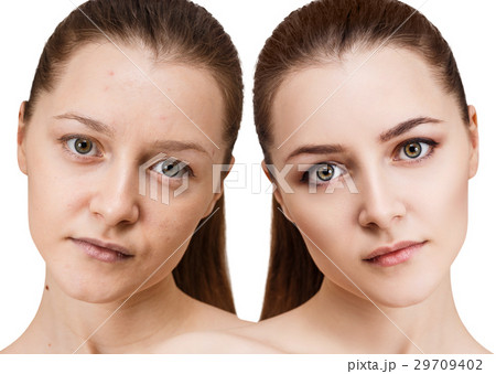 Young woman before and after makeup. 29709402