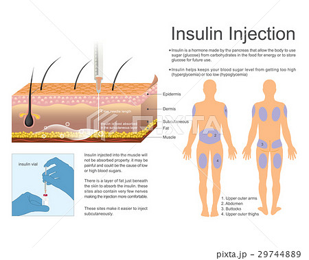 Insulin Injection 29744889