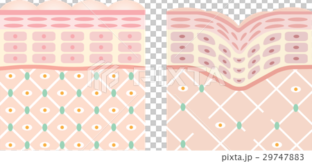 健康的皮膚皺紋皮膚橫截面 29747883