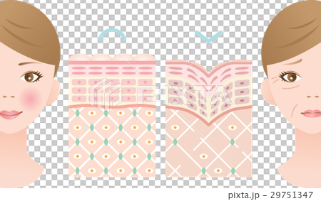 若い肌　しわ肌　断面図 29751347