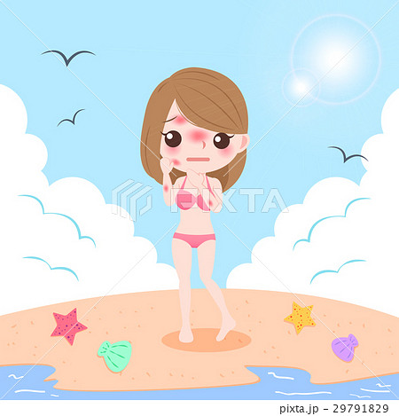 woman with sunburn problem 29791829