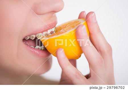 Girl with multi-colored braces tastes a lemon Girl with multi-colored braces tastes a lemon 29796702