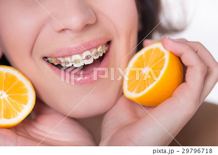 Girl with multi-colored braces tastes a lemon Girl with multi-colored braces tastes a lemon 29796718