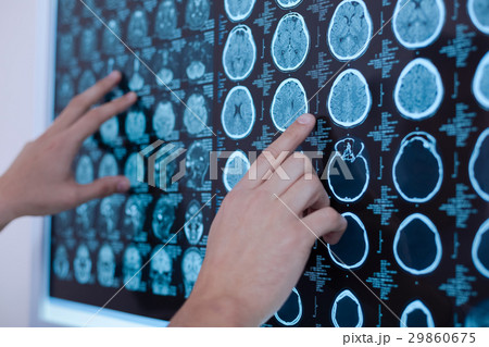 X ray images of human brain being put on the X ray images of human brain being put on the 29860675