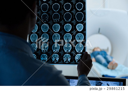 MRI scan images being examined by a doctor 29861215