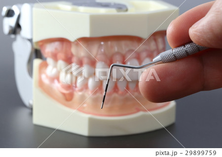 歯周病検診（プローブ） 29899759
