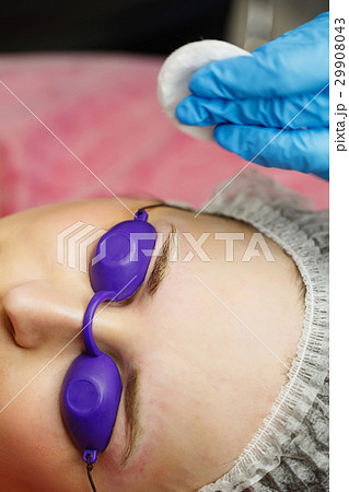 Laser removal of tattoo eyebrows 29908043