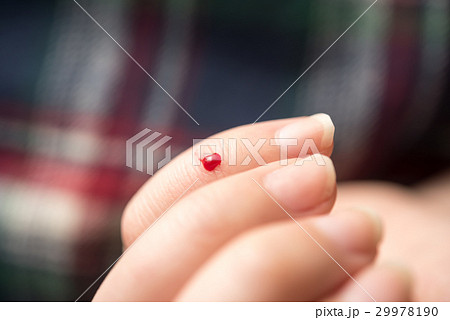 出血 29978190
