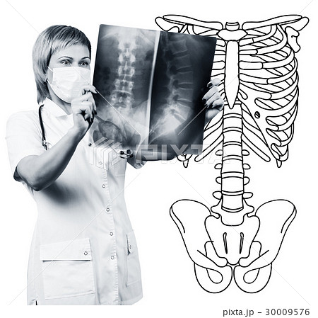 Female doctor looking at an x-ray. 30009576