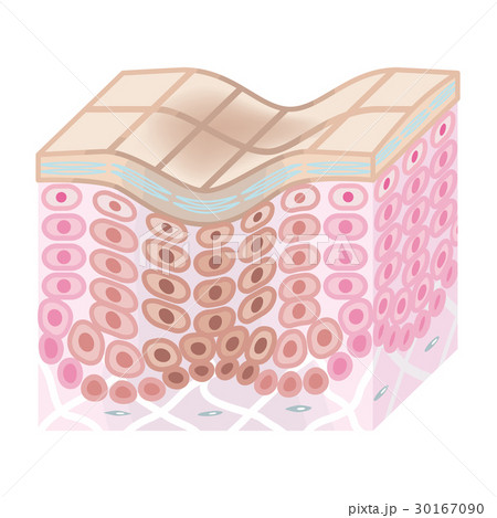 肌の断面図　老化 30167090