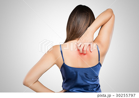 Woman scratching her itchy back with allergy rash Stock Photo by ©Anetlanda  157086218