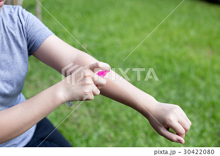 Woman spraying insect repellent on her arm Woman spraying insect repellent on her arm 30422080