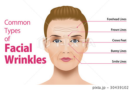 顔のシワの種類のイラスト素材