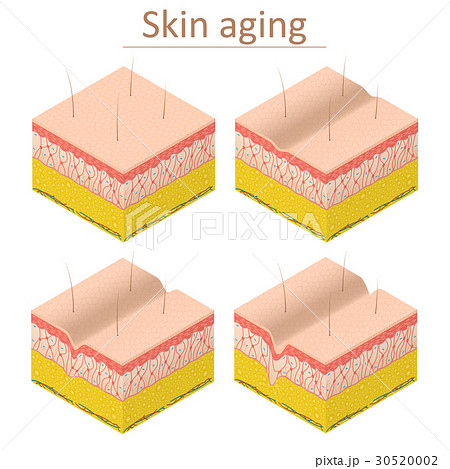 Skin Aging Set Isometric View. Vector 30520002