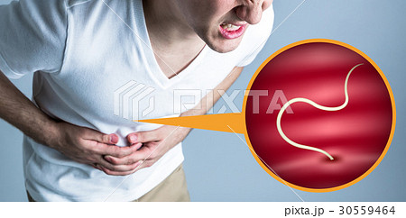 寄生虫と腹痛 寄生虫と腹痛 30559464