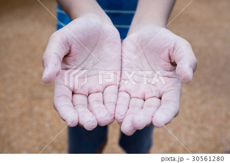 Boy open withered skin hands Boy open withered skin hands 30561280